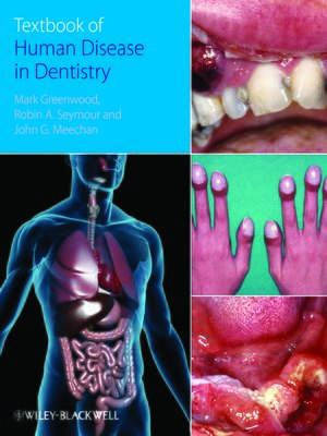 cover image of Textbook of Human Disease in Dentistry